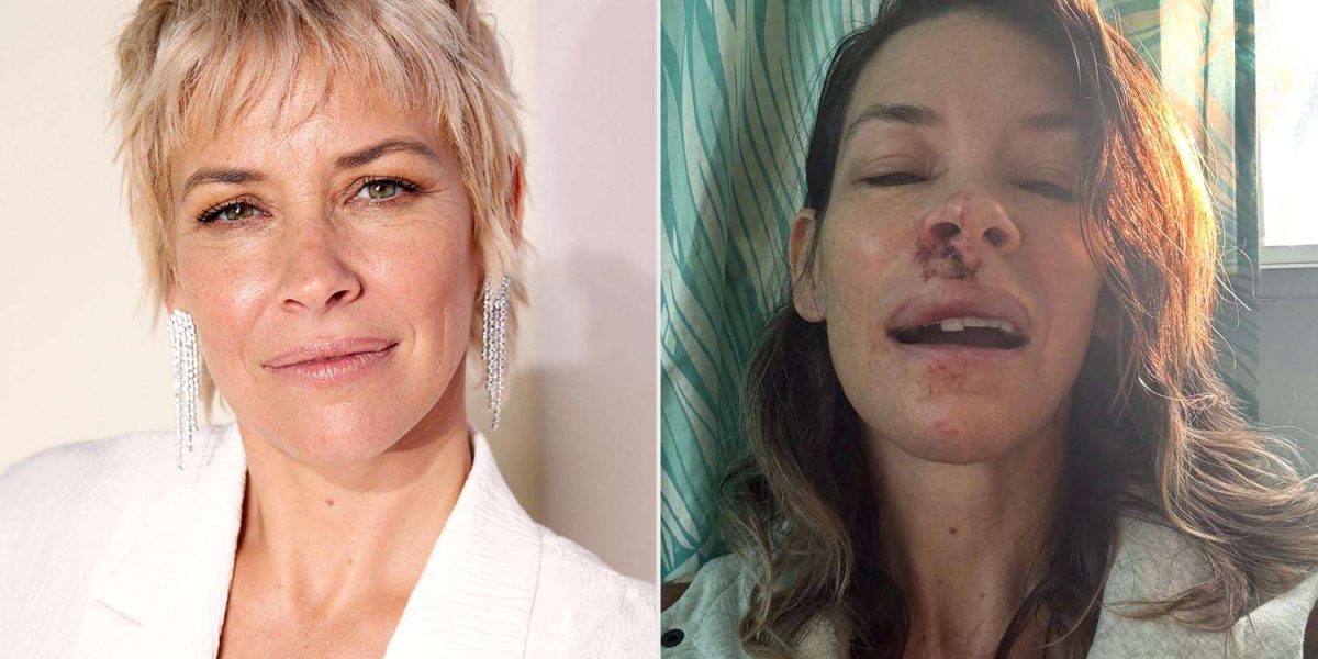 Evangeline-Lilly-D23-after-fall-010326-acf10f236c064bca96aebb2e74bdabf4.jpg - ReporterUrban