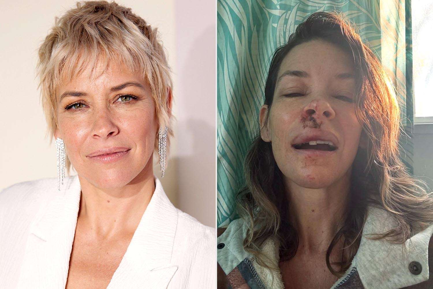 Evangeline Lilly dezvăluie: „Am leziuni cerebrale după o contuzie”