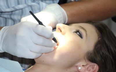 teeth-cleaning-1514692_1280.jpg - ReporterUrban