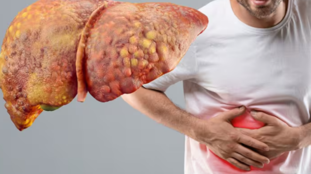 Ficatul, un organ vital pentru sănătate, se confruntă cu un număr tot mai mare de probleme cauzate de stilul de viață modern și alimentația dezechilibrată