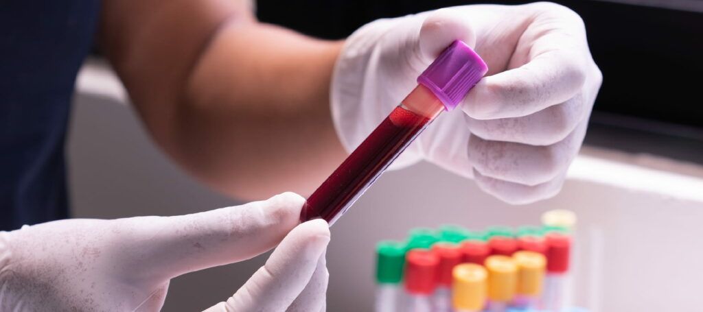 Un nou semnal de alarmă în domeniul sănătății publice: nivelurile de dioxid de carbon (CO2) din sângele uman au început să crească, o tendință care, dacă va continua, poate avea implicații serioase pentru sănătatea populației globale