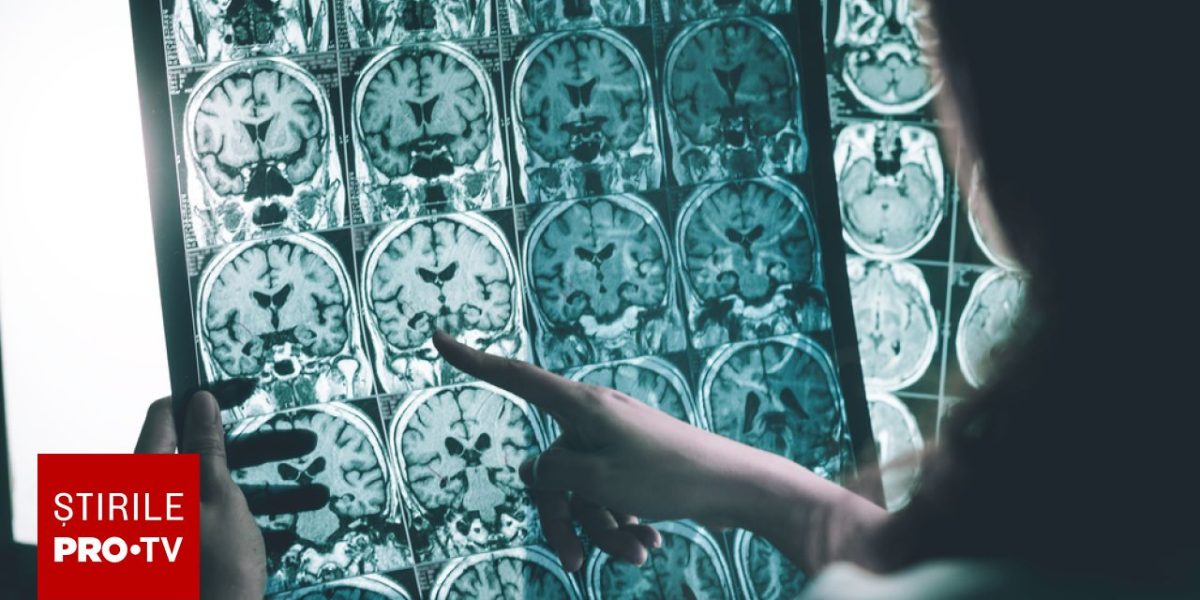Medicamente pentru Alzheimer: Analiză cruntă, riscuri mai mari decât beneficii