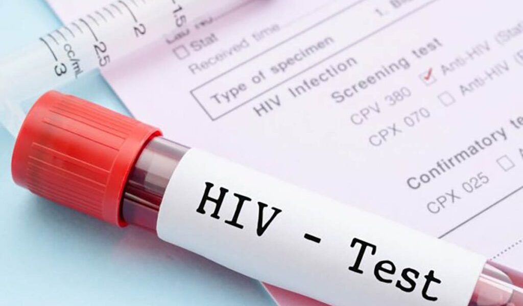 Bărbat vindecat de HIV fără tratament: Premieră medicală mondială