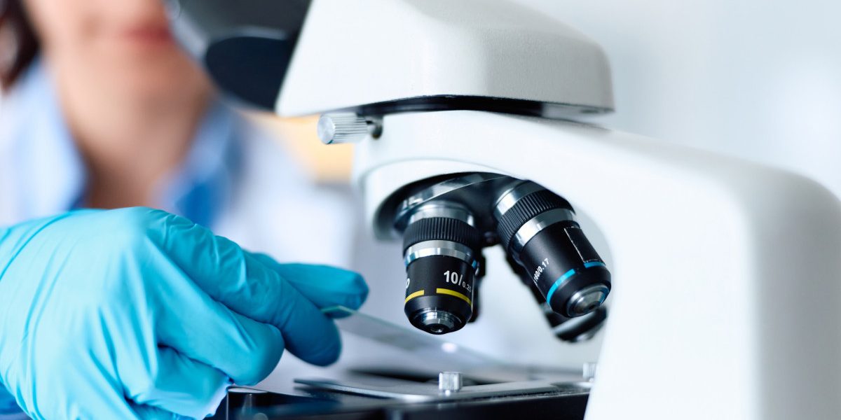 Indicii revoluționare în celule: Parkinson, tratamente schimbate