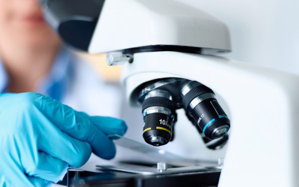 Indicii revoluționare în celule: Parkinson, tratamente schimbate