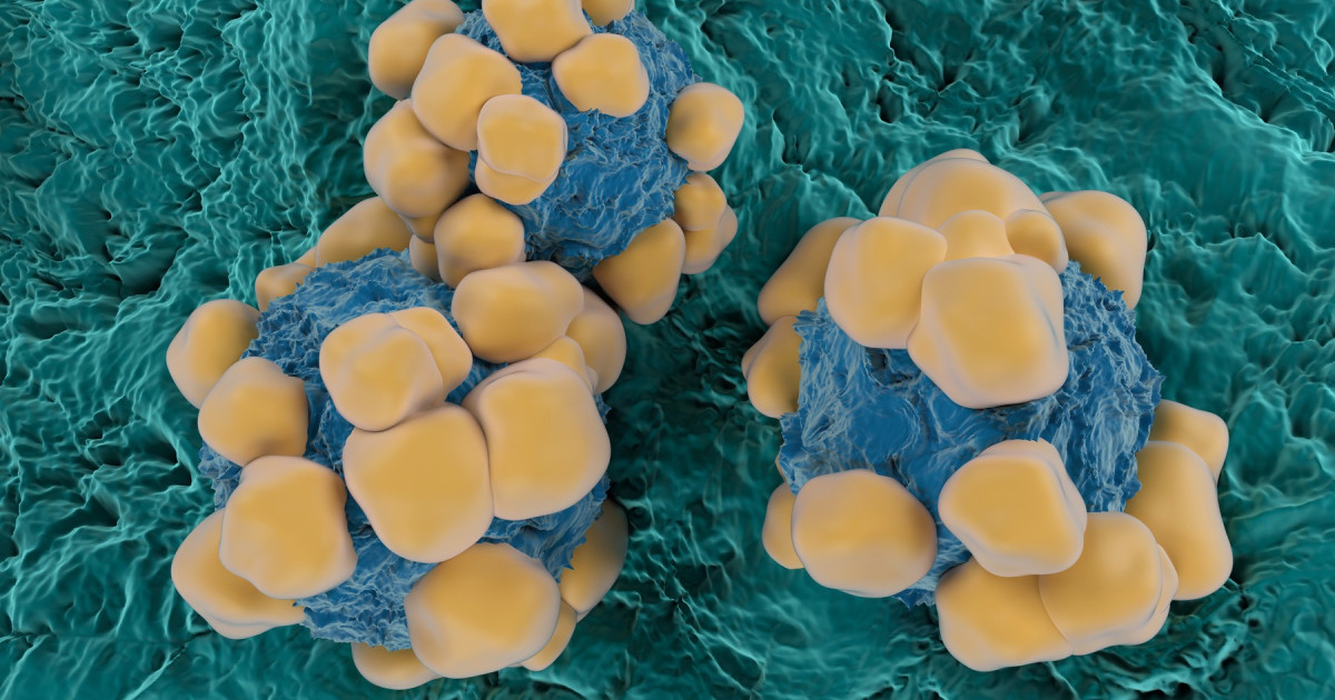 Oamenii de știință au dezvoltat senzori extrem de subțiri, de grosimea unui fir de păr, care pot detecta simultan mai mulți biomarkeri ai cancerului