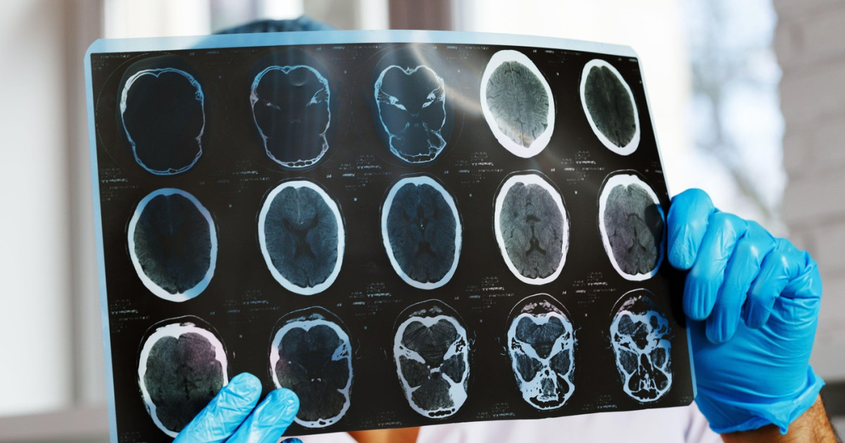 Asociațiile de pacienți cer intervenția Ministerului Sănătății după reducerea investițiilor în monitorizare cu 47%