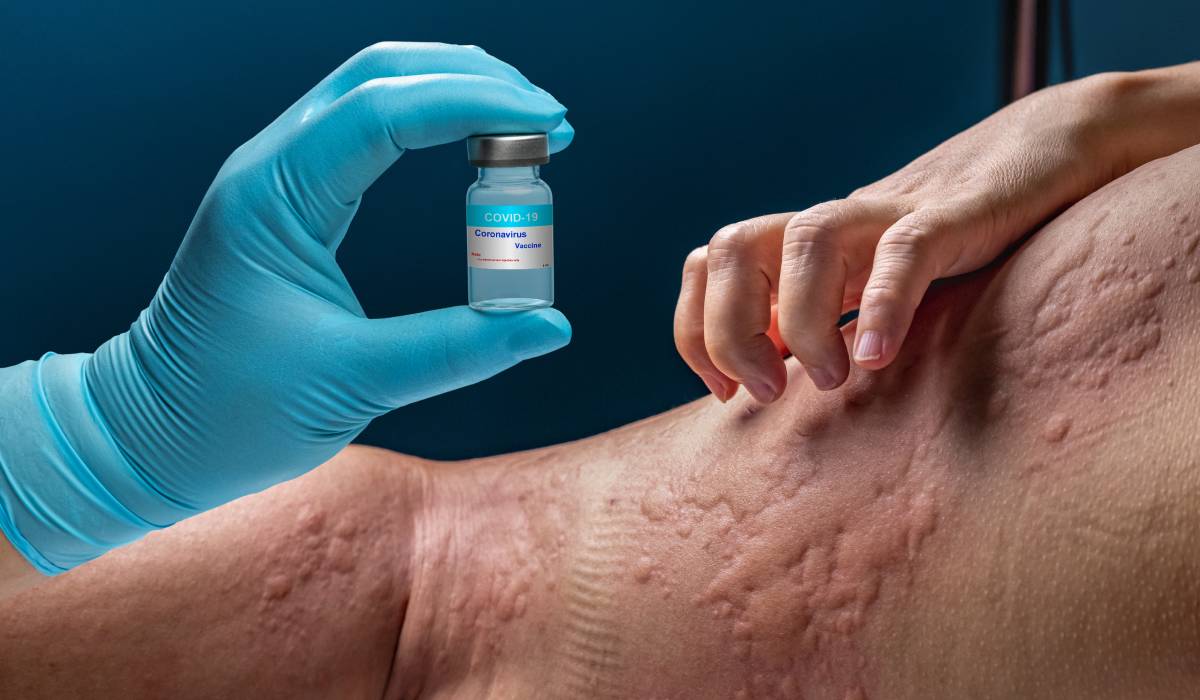 O tânără din România trăiește de peste 10 ani cu peste 40 de alergii alimentare și de mediu, însă acum a reușit să își schimbe complet viața după un tratament destinat astmului