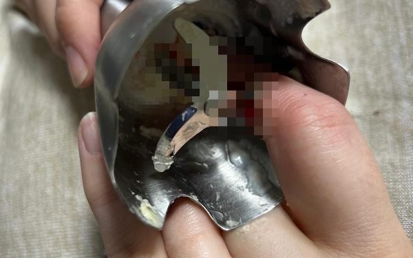 Accidente grave la Iași: Două femei, transportate de urgență la spital