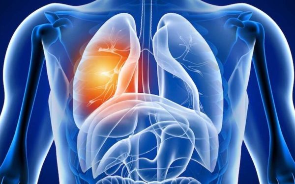 Alarmă după COVID: Ce probleme lasă virusul în plămâni