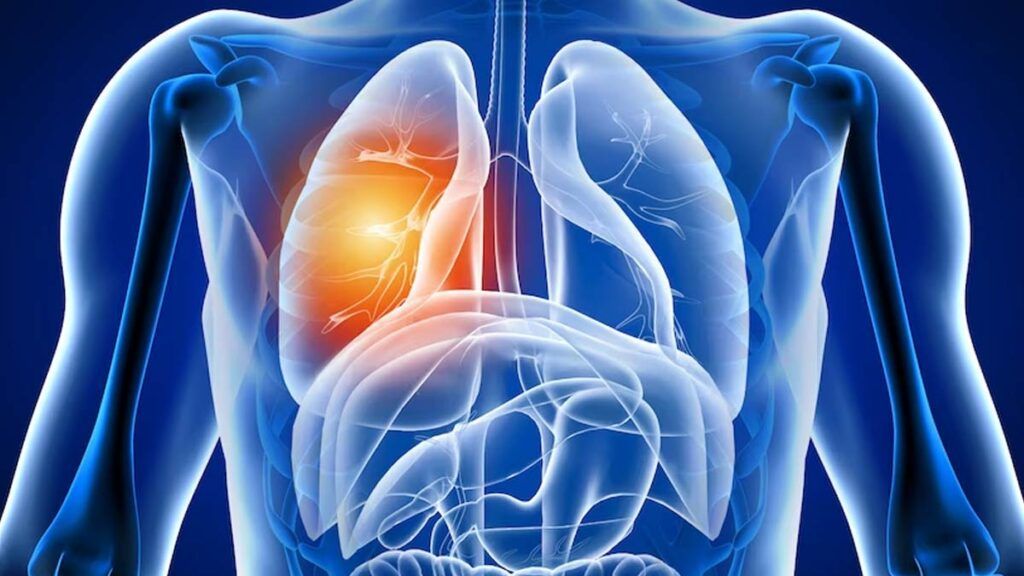 Alarmă după COVID: Ce probleme lasă virusul în plămâni