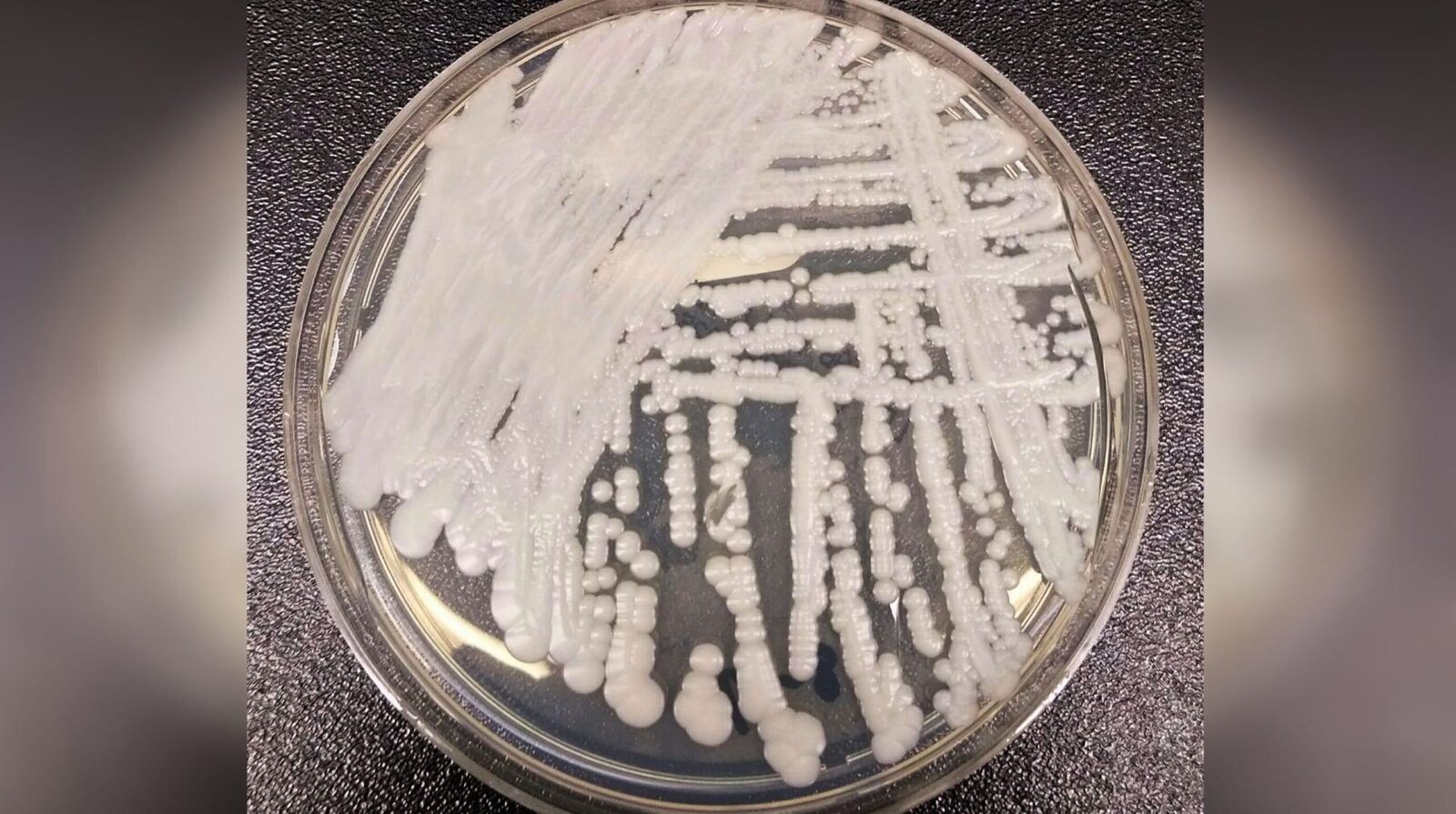 Candida auris, pericol în Europa: România face parte din lista neagră