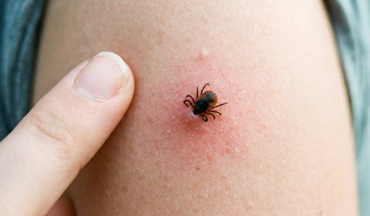 Cum să scapi de țânțari, căpușe și păianjeni: sfaturi utile
