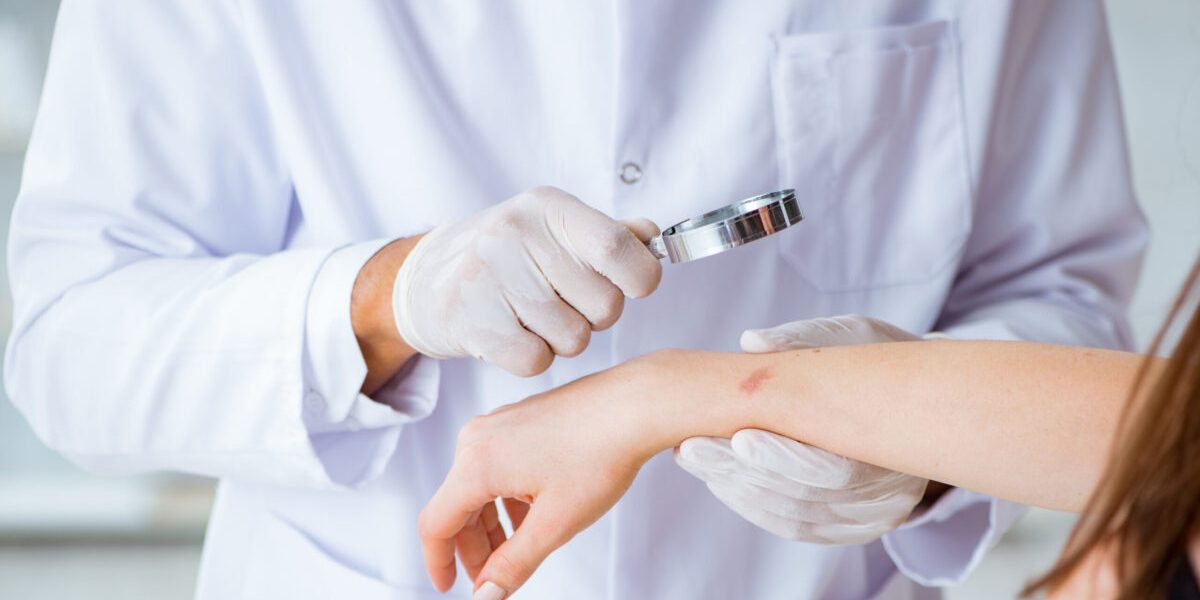 Ectima: Cauze, simptome și tratament eficient. Sfaturi de la medici pentru sănătate