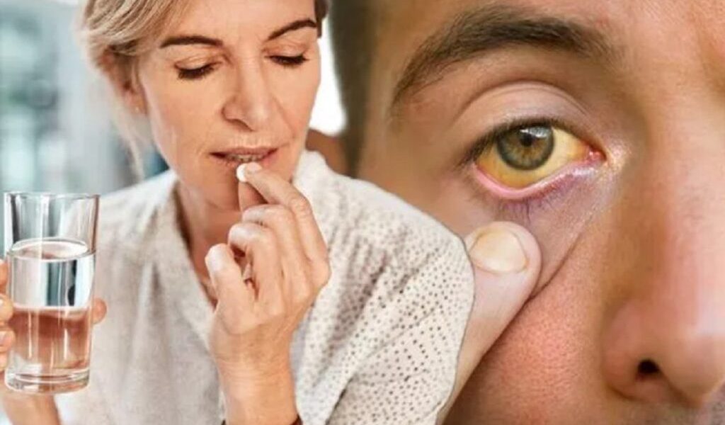 Aspirina zilnică: Doctorul avertizează milioane de români