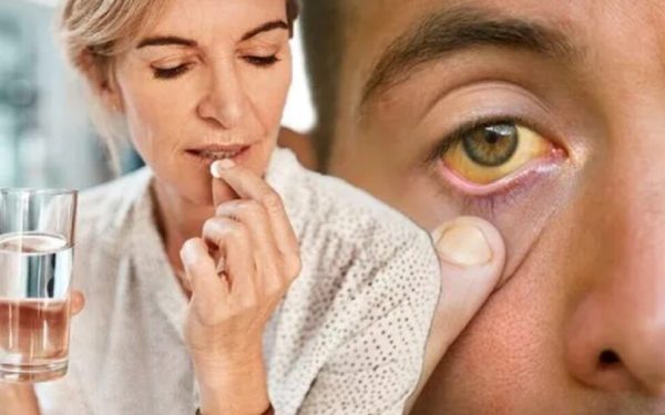 Aspirina zilnică: Doctorul avertizează milioane de români