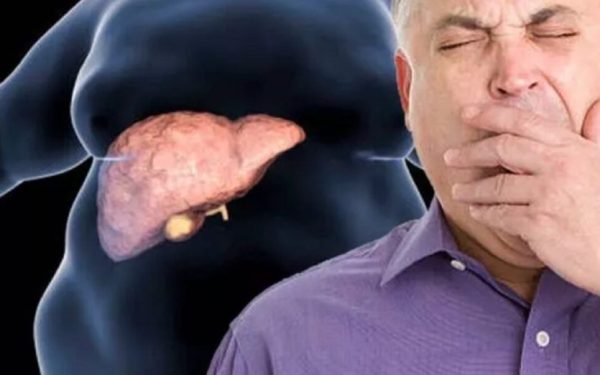 Boala ficatului gras: Tratament inovator, fără schimbări în dietă