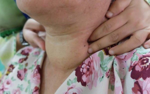 Boala „secretă” care te îngrașă: Dieta nu mai ajută, ce se întâmplă?