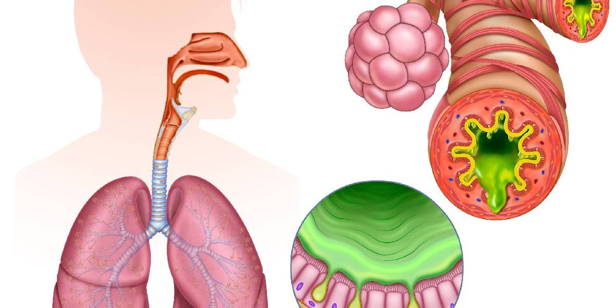 Inflamația cronică, „dușmanul invizibil”: Cum ne distruge sănătatea modernă