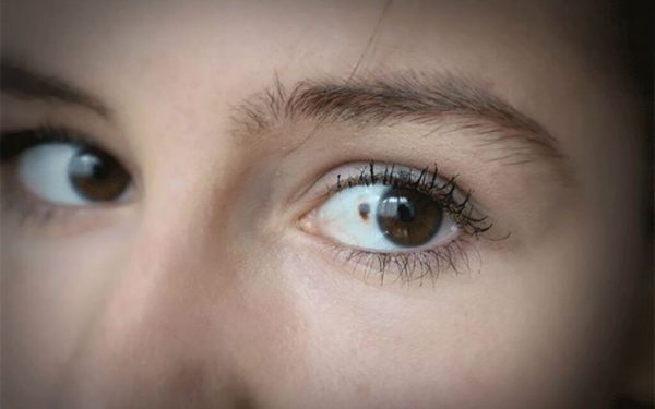 Uită-te-n Ochi: 11 semne TĂCUTE de cancer, depistabile din privirea ta!