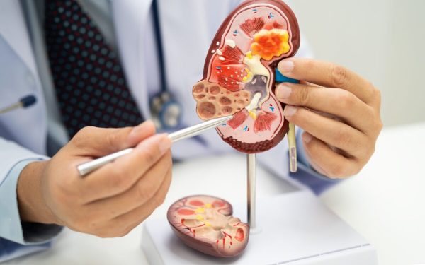 Acid uric și creatinină: ce semnalează analizele despre rinichi