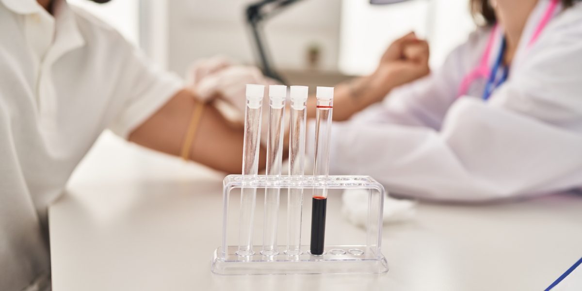 Sânge testat: 5 analize esențiale înainte de sală