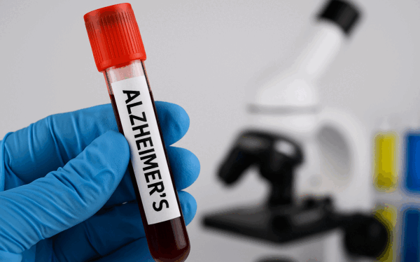Alzheimer, boală transmisă prin sânge? Șocul unui studiu românesc