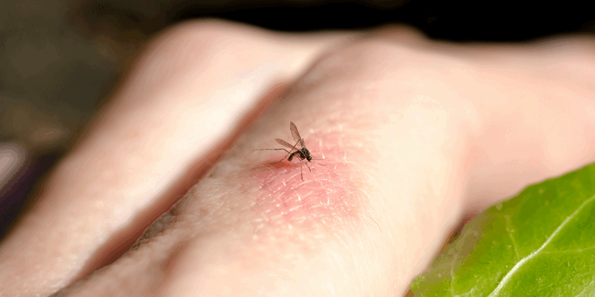 Scapă de viespi și țânțari: Soluții naturale de la specialiști