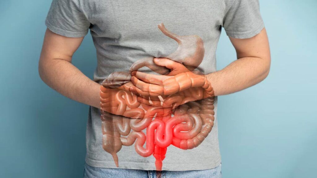 10 ani ignorat simptom banal, apoi cancer colon stadiul IV