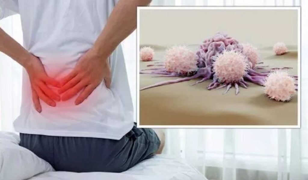 Cancerul tăcut: 5 simptome banale care ascund boala