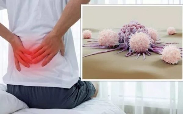 Cancerul tăcut: 5 simptome banale care ascund boala