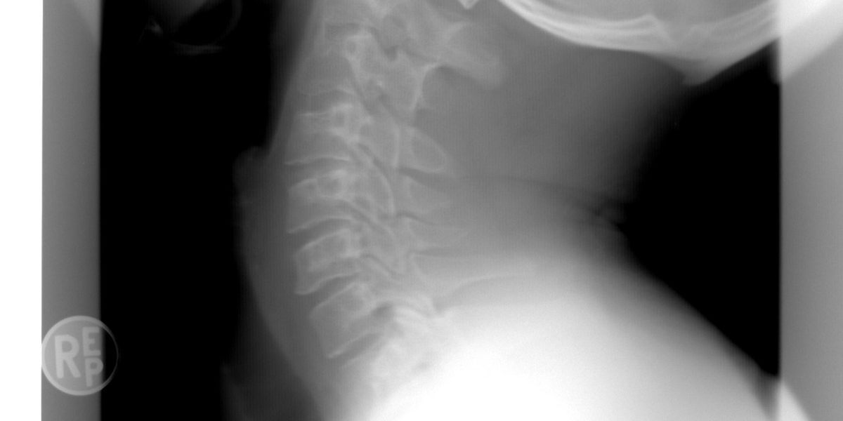 Spitalul Bihor: AI ajută radiologii la Urgențe
