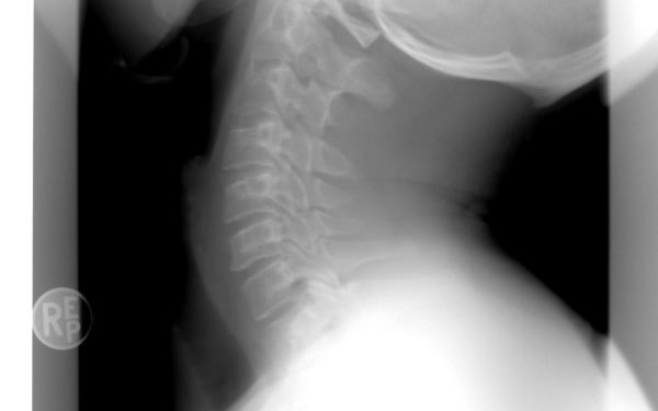 Spitalul Bihor: AI ajută radiologii la Urgențe
