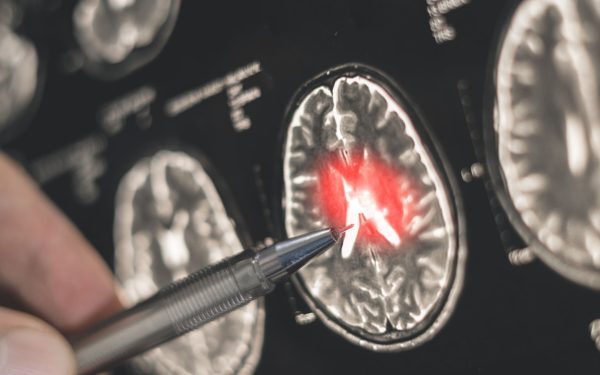 Hormonul iubirii și frica: Ce ascunde creierul. Descoperire uimitoare