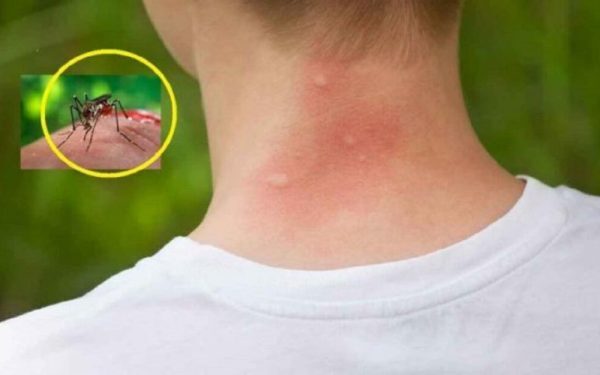 Țânțarii te aleg pe tine! Secretul bacteriilor dezvăluit