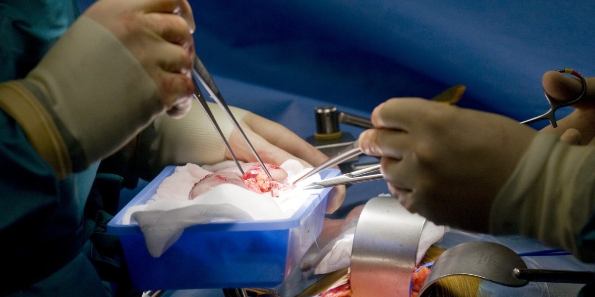 Rinichi de porc, succes medical: 271 de zile funcțional la un american