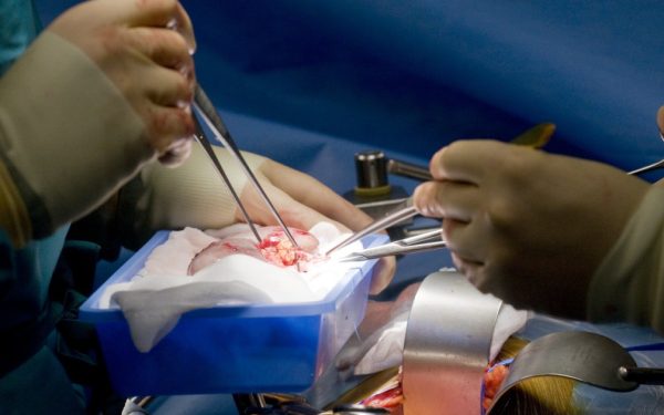 Rinichi de porc, succes medical: 271 de zile funcțional la un american