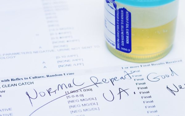 Test de urină: Depistează 9 din 10 cancere de vezică