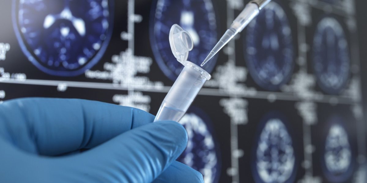 Vaccin vechi, leac nou contra demenței