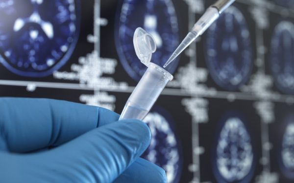 Vaccin vechi, leac nou contra demenței